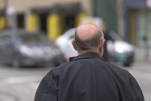 Polacy wstydzą się swoich łysin 