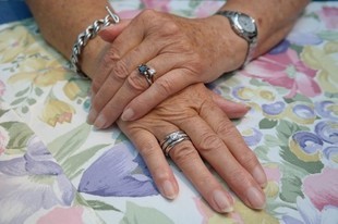 Twoje dłonie zdradzają twój wiek! Jak je odmłodzić?
