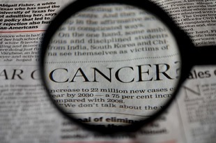 Zabija nas rak - 15 milionów wiecej zachorowań w 2013 roku