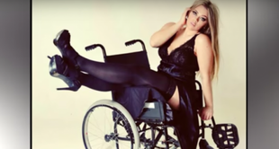Niepełnosprawna modelka plus-size pokazuje inne oblicze piękna