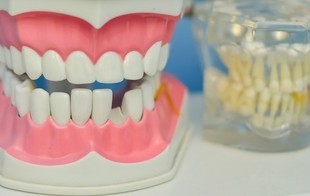 Brzydkie zęby postarzają o 13 lat!