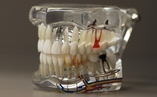 Czy wiecie, że nieleczone zęby mogą być przyczyną zawału!