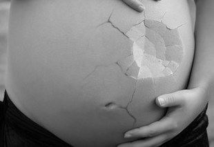 8 najczęstszych przyczyn utraty ciąży