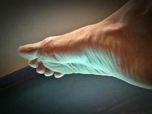 Jak radzić sobie z bolącymi stopami?