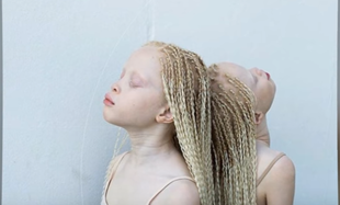 Bliźniaczki - albinoski z Brazylii podbiły świat mody