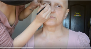 Przemiana pacjentki po chemioterapii