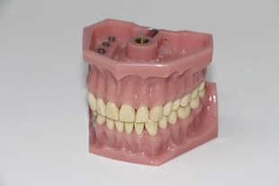 Cała prawda o noszeniu protez zębowych w różnym wieku