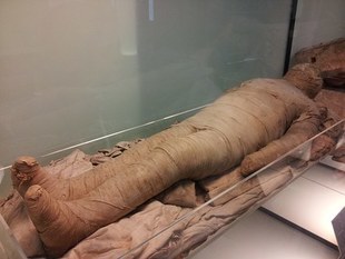 Mumie i miażdżyca. Choroba stara jak świat?
