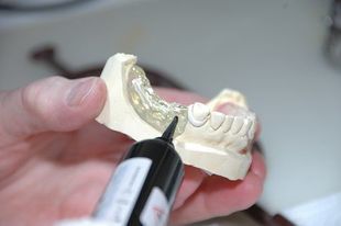Nowe zęby bez wycisków? Tak, jeśli "sklonujesz" swój uśmiech!