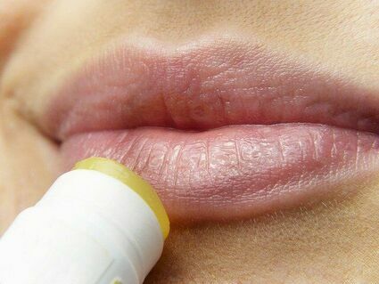 Opryszczka ust – skąd się bierze i w jaki sposób ją leczyć?