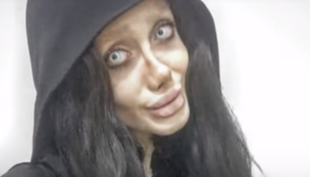 Zrobiła sobie 50 operacji, by wyglądać jak Angelina Jolie