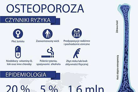 Osteoporoza - rosnące wyzwanie. Jak pomóc mieszkańcom?: Gmina Krośniewice