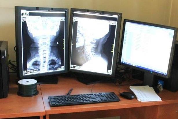 Zdjęcie monitorów i zdjęć rentgenowskich