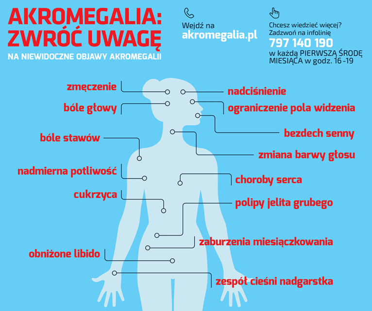 akromegalia